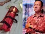 aktor-teuku-rifnu-wikana-ungkap-lima-keponakan-dan-sepupunya-jadi-korban-tabrak-lari.jpg