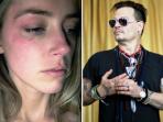 aktris-amber-heard-mengklaim-dirinya-pernah-dipukuli-suaminya-johnny-depp_20160529_210041.jpg