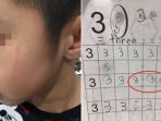 anak-tk-dipukul-guru_20180126_202753.jpg