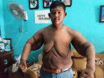aria-permana-bocah-obesitas-akan-jalani-operasi-lagi_3.jpg