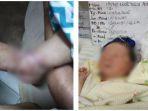 bagas-purwanto-balita-terjangkit-virus-rubella.jpg