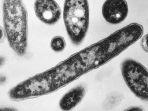 bakteri-legionella-pneumophila.jpg
