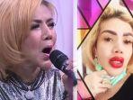 barbie-kumalasari-sulam-ingin-bibir-seksi-namun-malah-membengkak-irfan-sbaztian-reaksinya-menohok.jpg