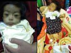 bayi-8-bulan-di-sumbar-divonis-serosis-hati.jpg