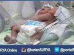 bayi-berkepala-dua_20160810_114152.jpg