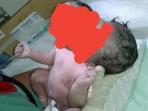 bayi-berkepala-dua_20160915_170626.jpg
