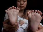 bayi-dengan-16-jari-kaki-dan-15-jari-tangan_20160506_220102.jpg