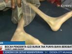 bayi-gizi-buruk-di-garut_20150519_212141.jpg