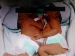 bayi-kembar-siam-safira-dan-saqira_20160721_114040.jpg