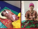 bayi-kembar-siam_20180307_154750.jpg