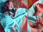 bayi-lahir-dengan-26-jari-kaki-dan-tangan-keluarga-gembira-dan-anggap-titisan-dewi-hindu-di-india-2.jpg
