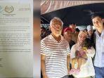 bayi-malaysia-idap-werewolf-syndrome-2.jpg