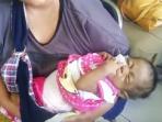 bayi-penderita-atresia-bilier_20160315_200007.jpg