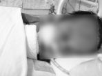 bayi-pengidap-meningitis_20180420_080335.jpg