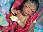 bayi-perkawinan-sedarah_20170804_225824.jpg