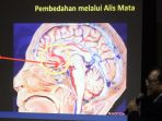 bedah-tumor-otak-lewat-alis-mata_20171013_195754.jpg