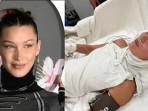 Supermodel Bella Hadid Lemas Tak Berdaya Diinfus karena Lyme Disease Penyakit yang Disebabkan Kutu