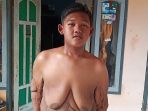 berat-badan-mantan-penyandang-obesitas-arya-permana-menurun_20190616_203713.jpg