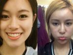 berry-ng-melakukan-operasi-plastik-30-kali-demi-dipuji-cantik-oleh-pacarnya_20171205_122554.jpg