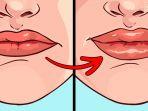 bibir-bengkak.jpg