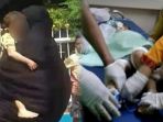bocah-6-tahun-korban-ledakan-di-pasuruan-diduga-anak-pemilik-bom-alami-luka-di-kaki-dan-wajah_20180705_185314.jpg