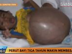 bocah-perut-buncit_20170124_034806.jpg