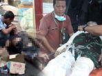 briptu-yudi-jalani-bedah-plastik-hari-ini.jpg