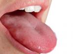 cadel-mulut-lidah-bicara-speaking_20141127_180559.jpg