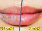 cara-atasi-bibir-kering-saat-puasa.jpg