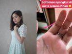 cara-mudah-mengeluarkan-softlens-tersangkut-di-mata-seperti-yang-dialami-tasya-kamila.jpg