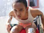 cecep-mulyadi-17-remaja-yang-kakinya-lumpuh-warga-blok-celeng.jpg