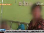 cemburu-suami-siram-istri-dan-anak-dengan-air-keras_20170110_161803.jpg