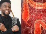 chadwick-boseman-meninggal-dunia-karena-kanker-usus-besar.jpg