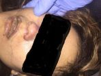cindy-ditemukan-tewas-dibunuh-perampok_20170722_201236.jpg