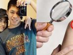 ciri-orang-yang-berisiko-terkena-kanker-melanoma_20180522_093308.jpg