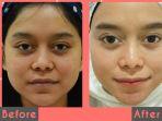 derma1.jpg