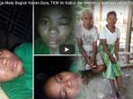 disiksa-hingga-mata-bagian-kanan-buta-tkw-ini-kabur-dan-meminta-bantuan-untuk-pulang-ke-indonesia_20180504_234939.jpg