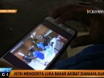 disiram-bensin-oleh-suami-sang-istri-derita-luka-bakar_20170401_121431.jpg