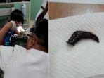 dokter-mengeluarkan-lintah-dari-hidung-bocah-45-tahun.jpg