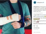 ed-sheeran-patah-tangan_20171027_194515.jpg