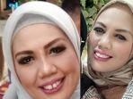 elly-sugigi-lakukan-potong-gigi.jpg