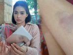 fakta-fakta-wanita-di-solo-dihajar-kakaknya-alami-luka-lebam-karena-dilempar-piring-dan-panci.jpg