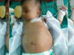 fetus-in-fetu.jpg