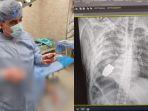 foto-dokter-militer-ukraina-yang-mengoperasi-tubuh-seorang-tentara.jpg