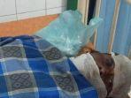 foto-korban-jumadi-yang-terbakar-80-persen-istri-bakar-suami.jpg