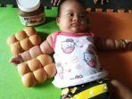 foto-lengan-bayi-seperti-roti-sobek.jpg