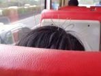 foto-seseorang-di-dalam-bus-dengan-sembilan-jarum-akupunktur.jpg