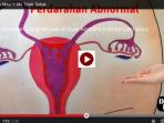gambar-vagina_20150212_111103.jpg