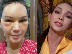 Serasa Kembali Remaja, Bunda Corla Ingin Jatuh Cinta Lagi Usai Pamer Hasil Operasi Plastik