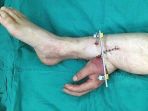 hand-to-leg_20171101_134304.jpg